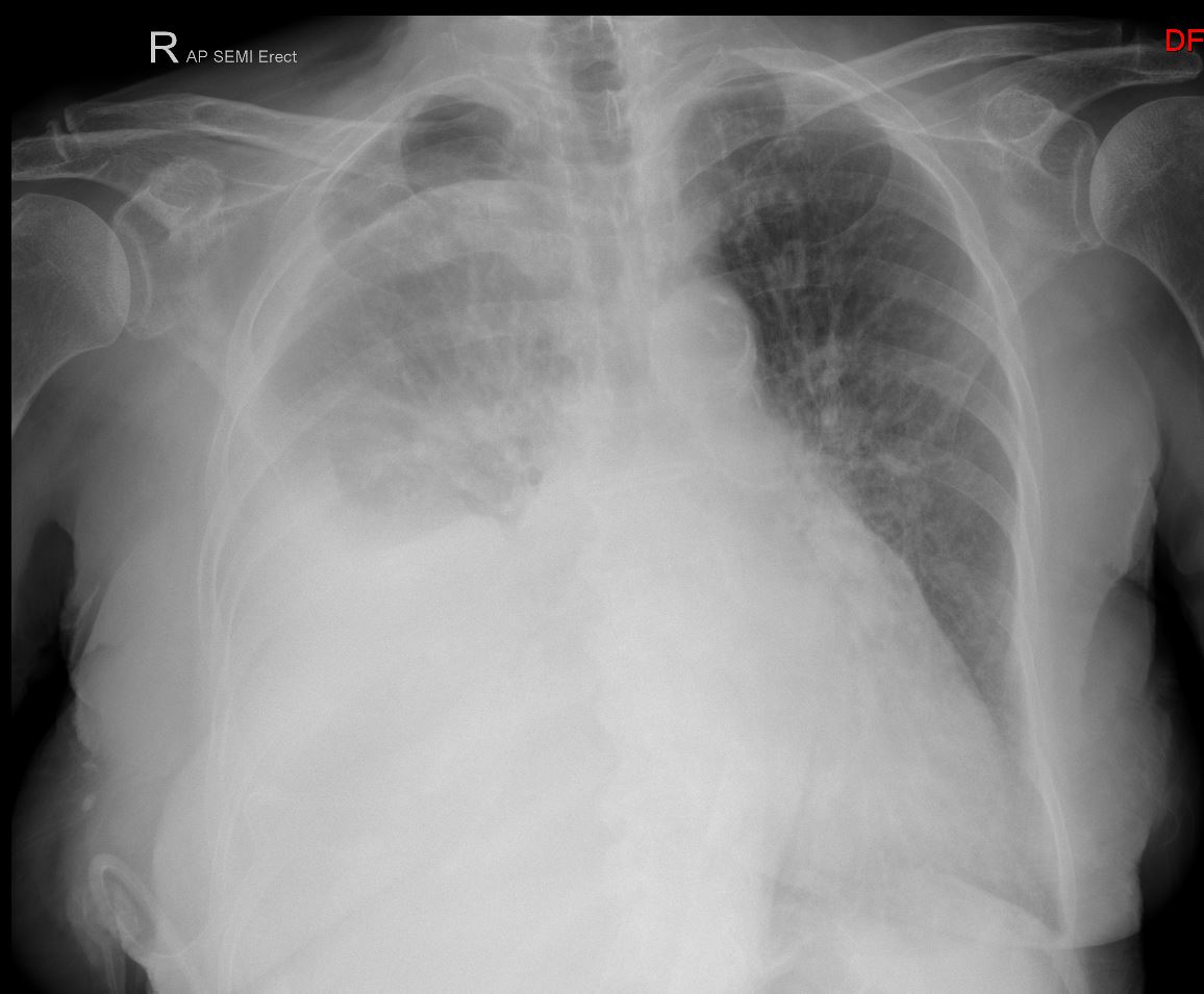 Case 1